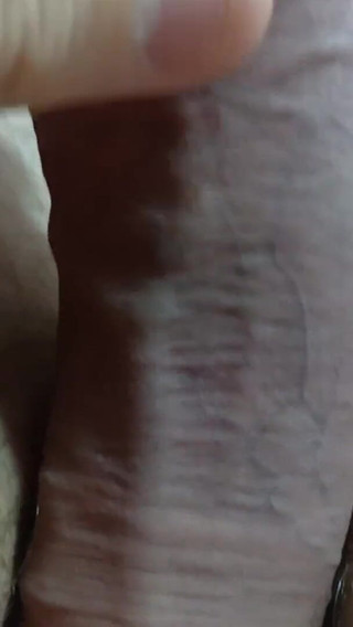 Big Uncut Tight Forskin Cock - Phimosis, Short Cock Play