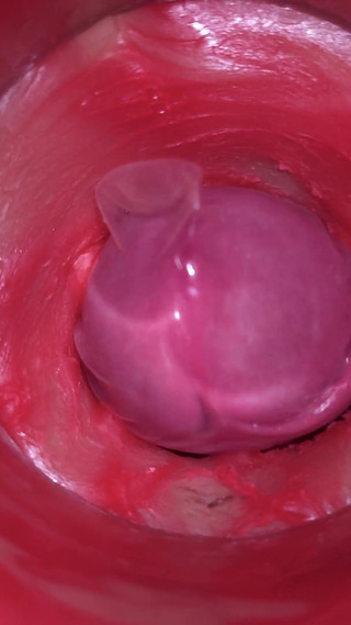 Camera Inside Pussy: Powerfull Cum in Pussy! Best Internal Asmr in 4K More Sperm