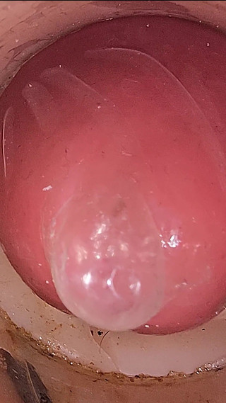 The Camera in the Deep Pussy Records a Huge Ejaculation of Sperm Into the Condom