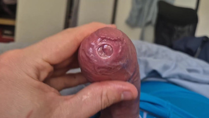 Phimosis Cock Precum Drip Close-up