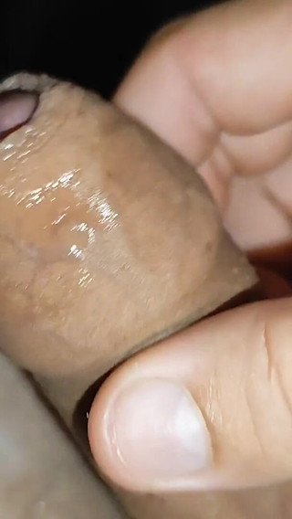 Big Dick at the Limit Gets Shocks for Resuscitation.