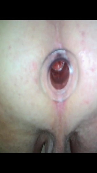 Anal Gape Extreme Close up Views