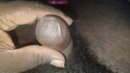 Foreskin Cock