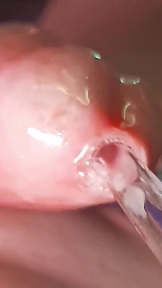 Oh My God! I Penetrate My Penis Eye!