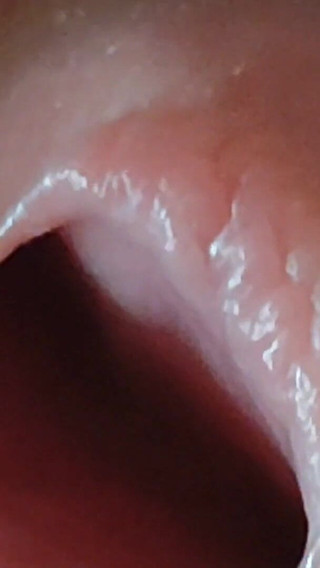 Entering the Glans of Pleasure!!!