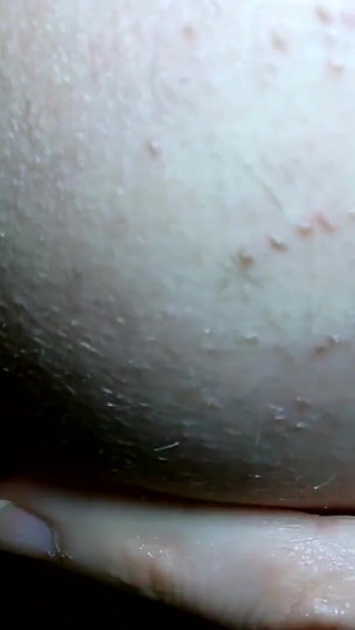 Mein Loch in Nahaufnahme