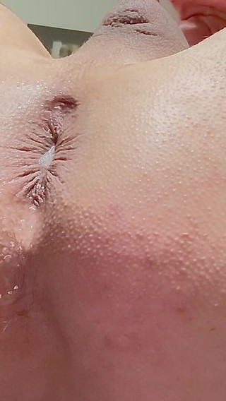 Loose Hole After Inflatable