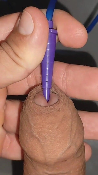 Penis Probing with Application of Fortifying Serum.