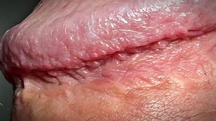 Peeing on the Testicles